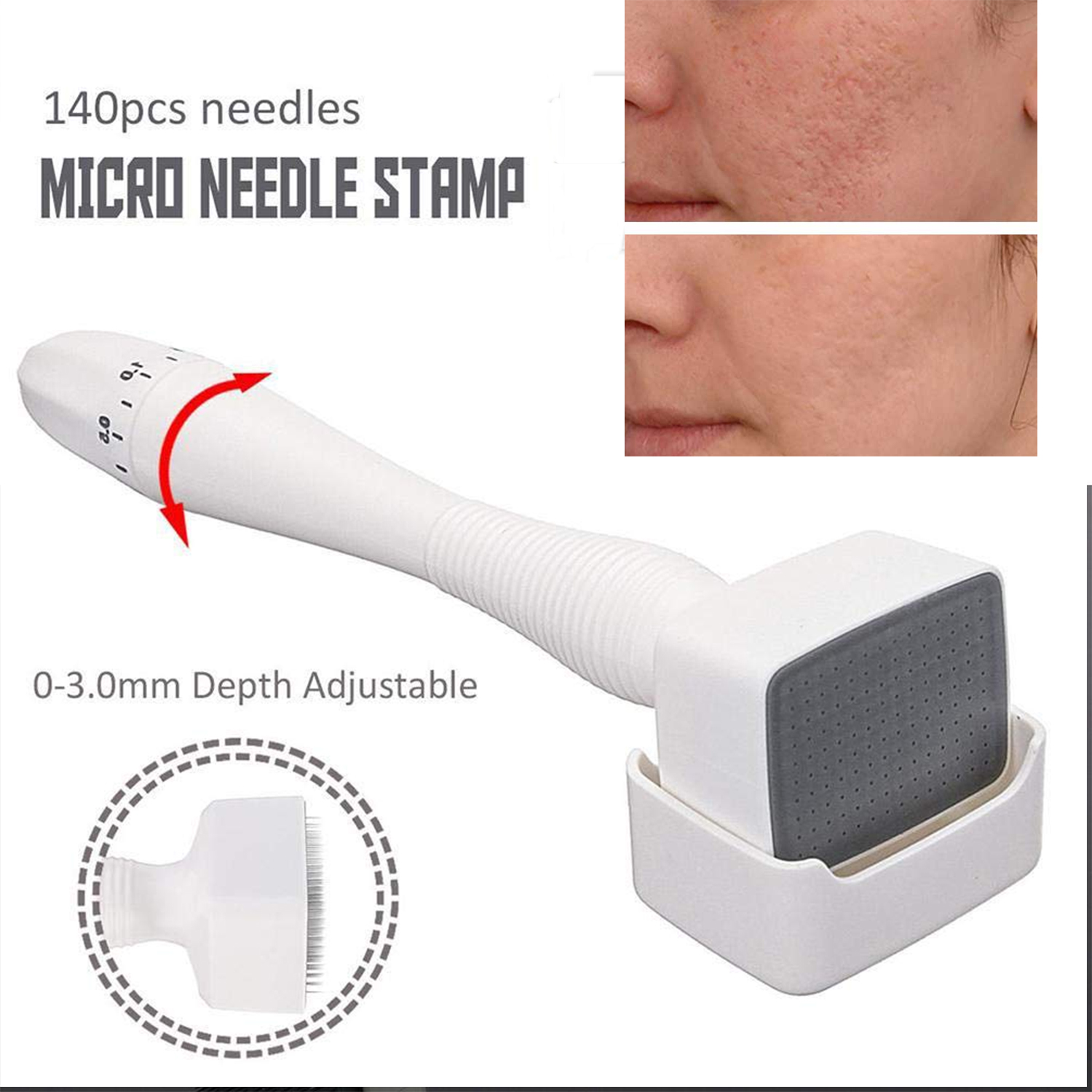 Derma Stamp Skin Stamp Adjustable 140 Tip 0 3.0mm Stainless Steel for